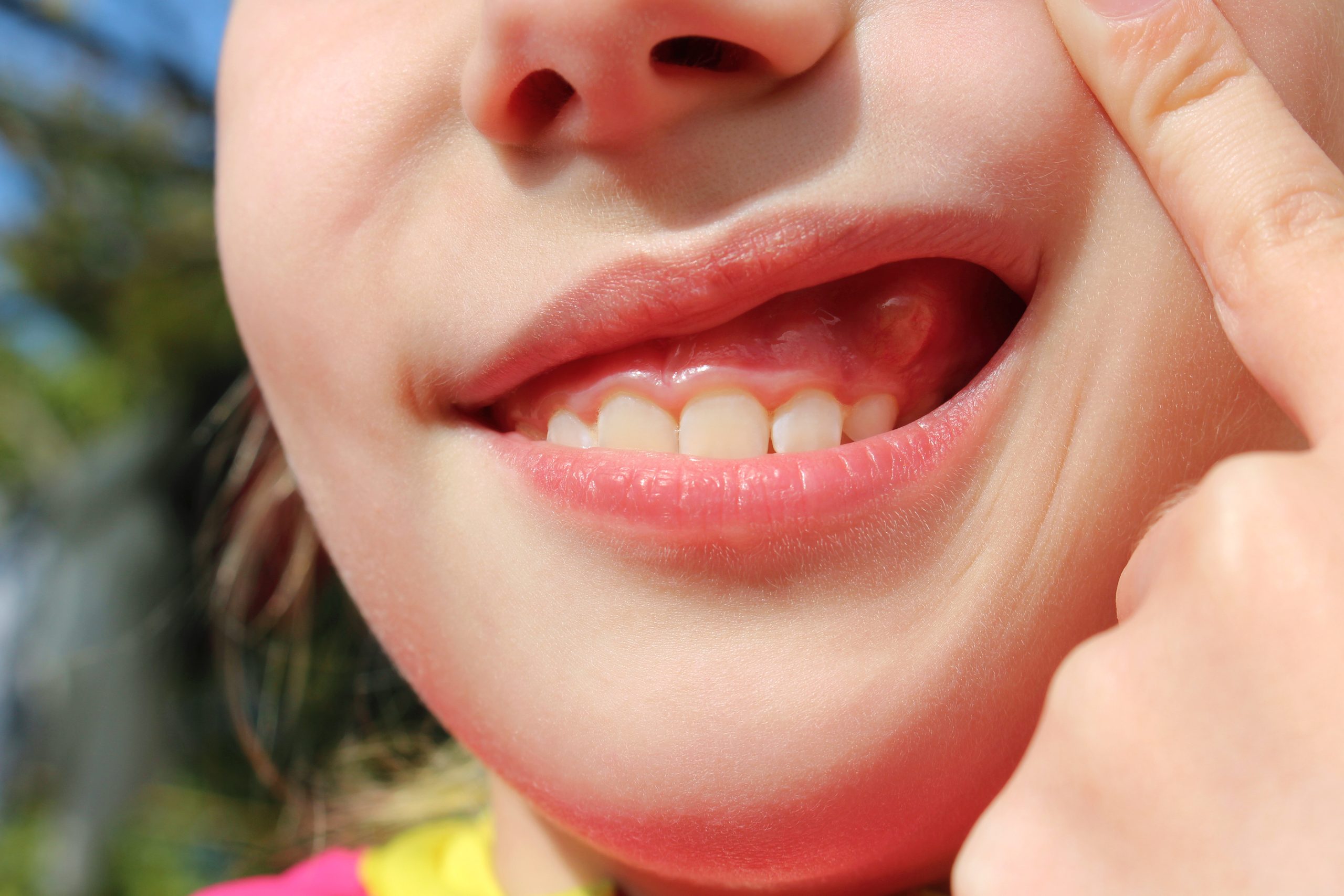 Ways To Keep Your Gums Healthy