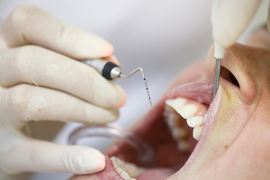 Understanding and Treating Periodontal Disease in Bellflower, CA