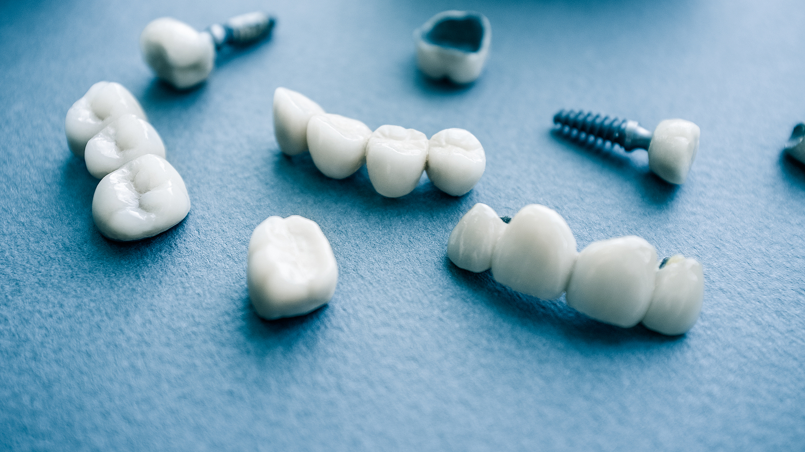 Prosthodontics in Bellflower, CA: Restoring Your Smile with Expert Dental Care